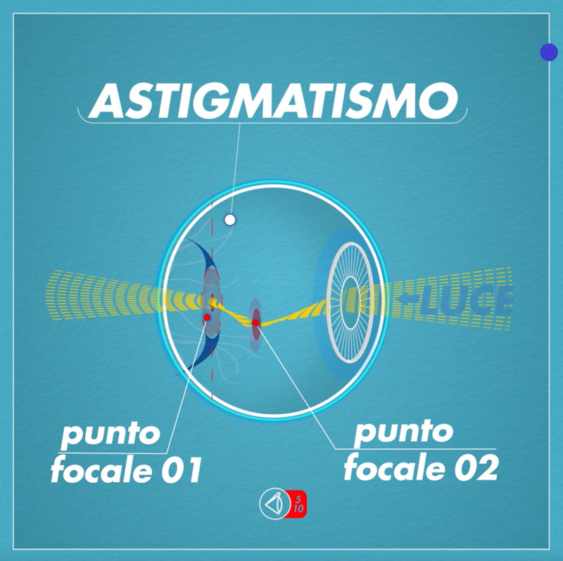 Occhio-Astigmatico-web