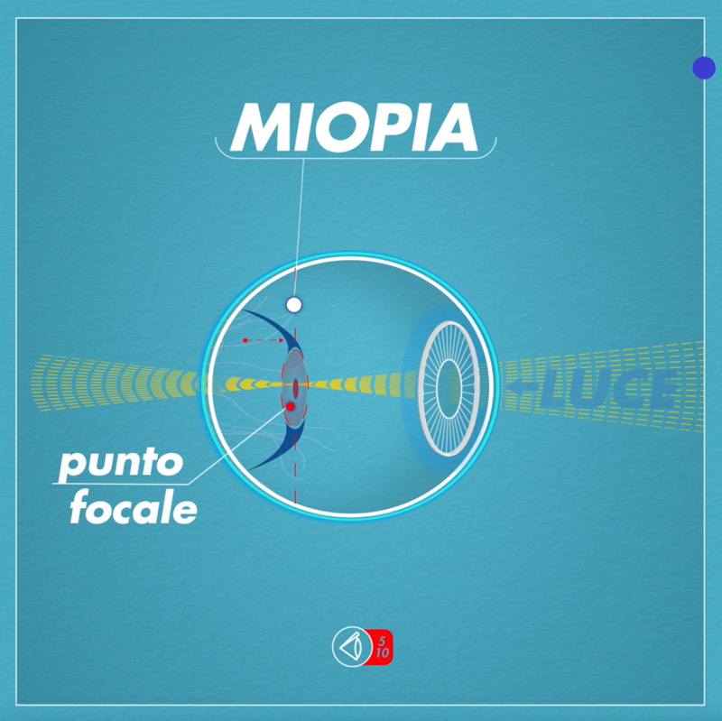 Occhio-Miope-web
