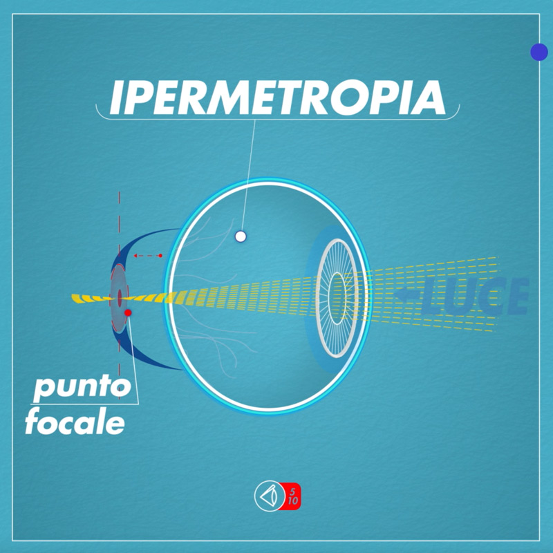 Occhio-ipermetrope-web