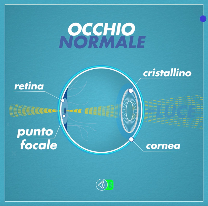 Occhio-normale-web