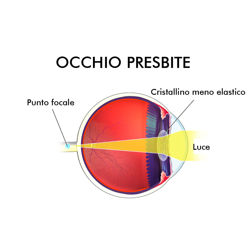 presbi-2